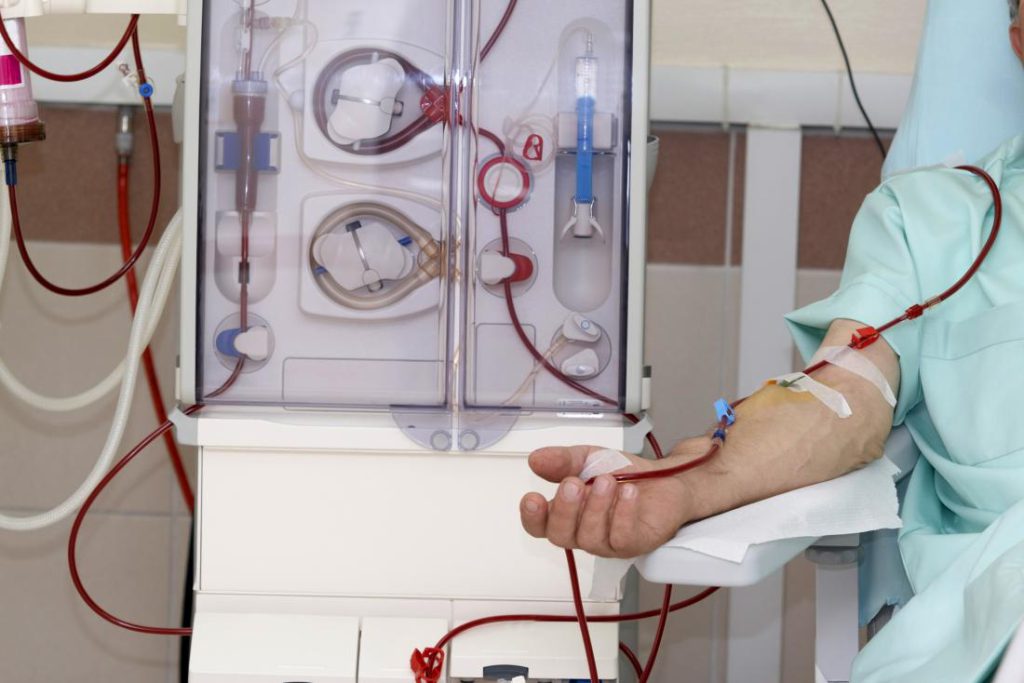 Dialysis is required only at end stage kidney diseases