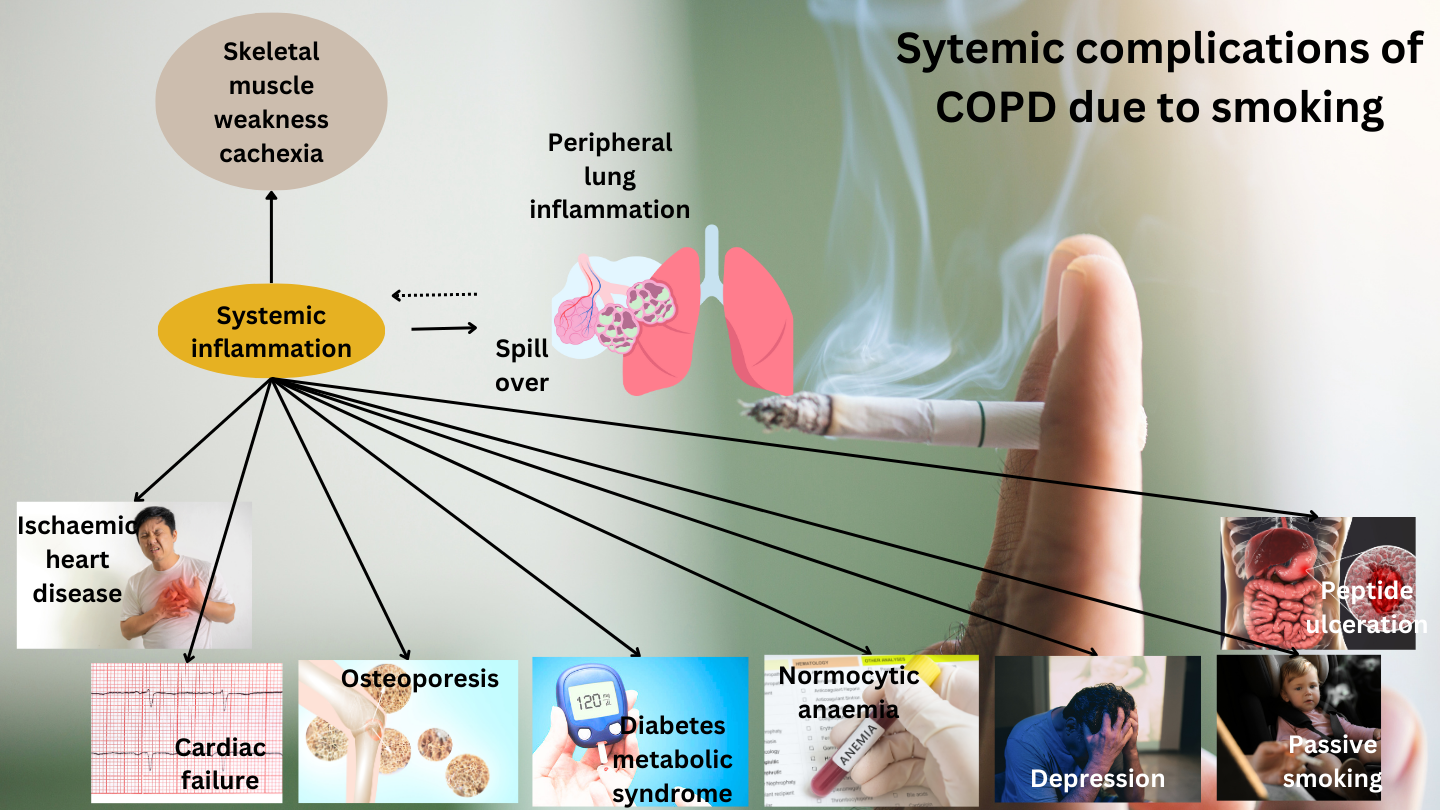 complications of smoking