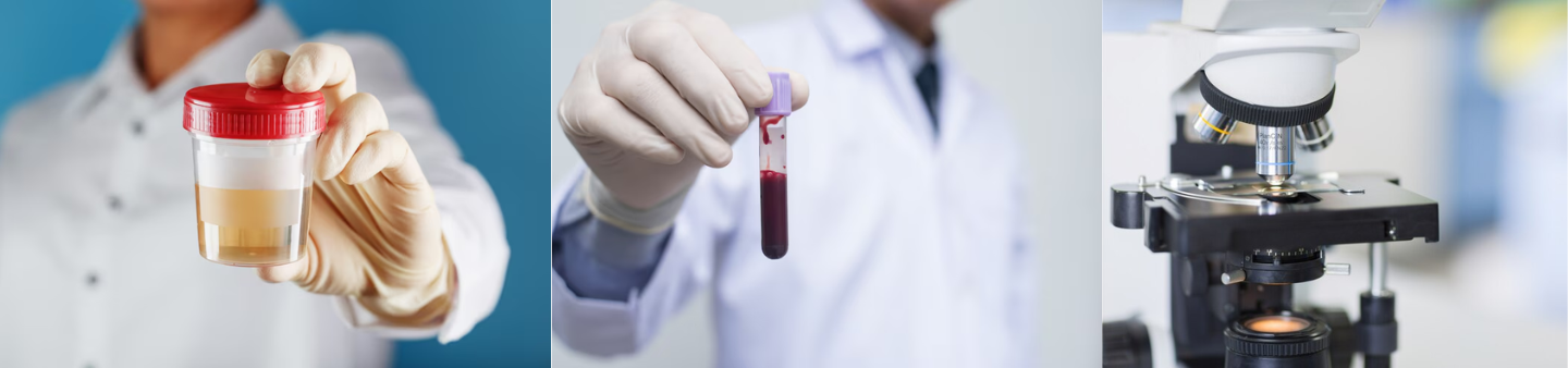 urine test, blood tests, and kidney biopsy - diagnosis for lupus nephritis