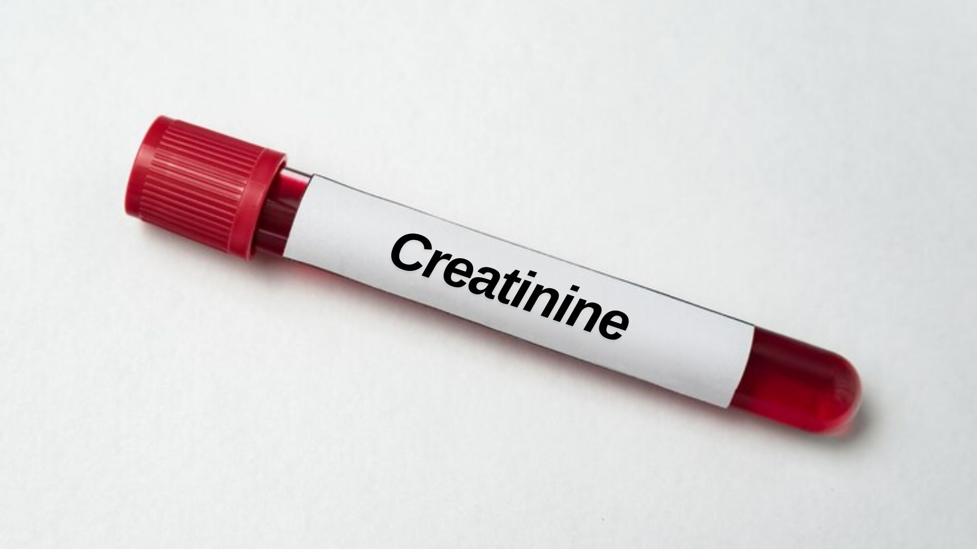 Creatinine levels